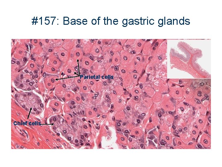 #157: Base of the gastric glands Parietal cells Chief cells 