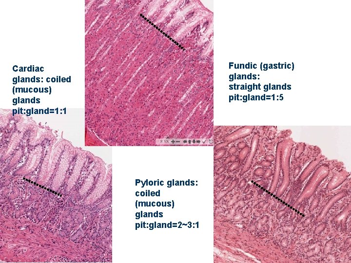 Fundic (gastric) glands: straight glands pit: gland=1: 5 Cardiac glands: coiled (mucous) glands pit: