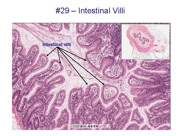 #29 – Intestinal Villi Intestinal villi 