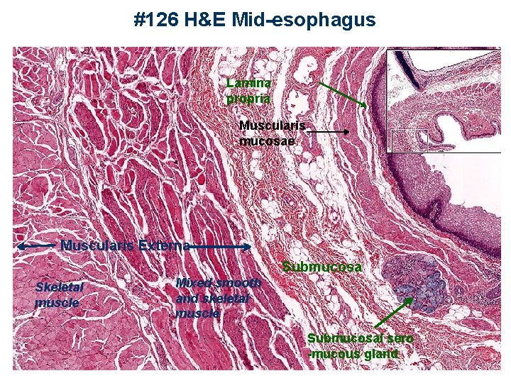 #126 H&E Mid-esophagus Lamina propria Muscularis mucosae Muscularis Externa Submucosa Skeletal muscle Mixed smooth
