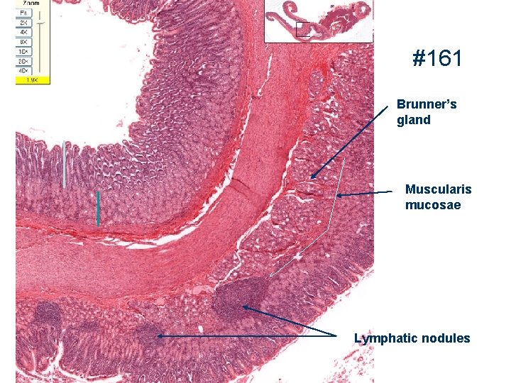 #161 Brunner’s gland Muscularis mucosae Lymphatic nodules 