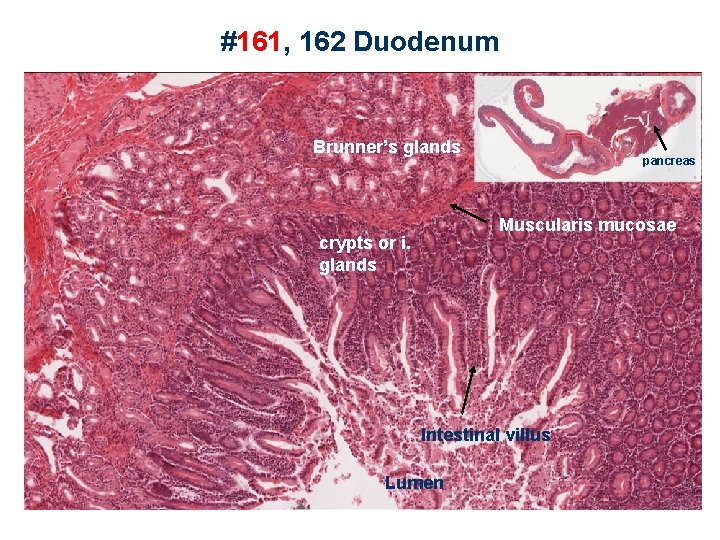 #161, 162 Duodenum Brunner’s glands pancreas Muscularis mucosae crypts or i. glands Intestinal villus