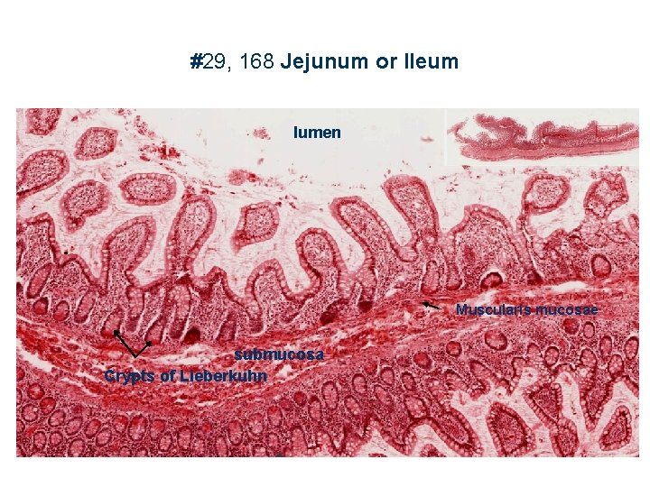 #29, 168 Jejunum or Ileum lumen Muscularis mucosae submucosa Crypts of Lieberkuhn 