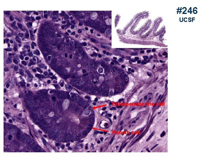 #246 UCSF Enteroendocrine cell Paneth cell 