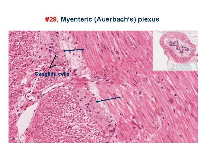 #29, Myenteric (Auerbach’s) plexus Ganglion cells 