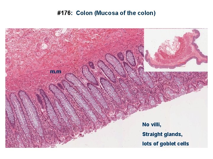 #176: Colon (Mucosa of the colon) m. m No villi, Straight glands, lots of
