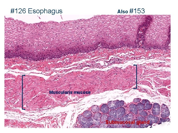 #126 Esophagus Also #153 Muscularis mucose Submucosal gland 