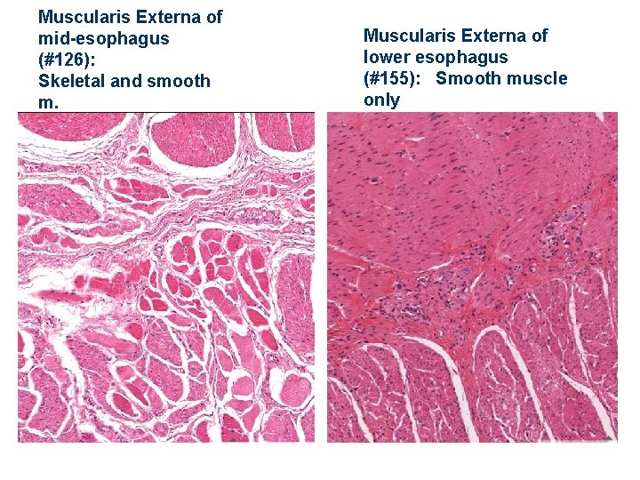Muscularis Externa of mid-esophagus (#126): Skeletal and smooth m. Muscularis Externa of lower esophagus