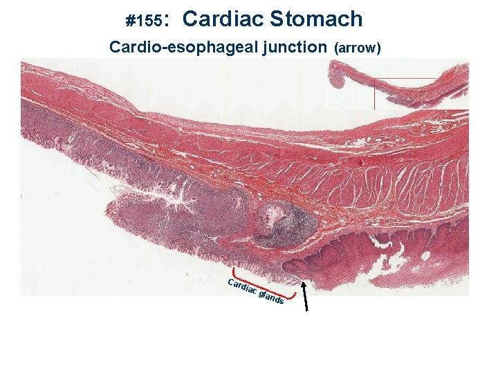 #155: Cardiac Stomach Cardio-esophageal junction (arrow) Car dia cg lan ds 