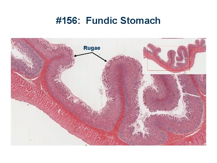 #156: Fundic Stomach Rugae 