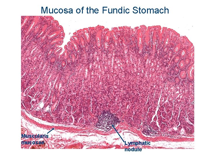Mucosa of the Fundic Stomach Muscularis mucosae Lymphatic nodule 