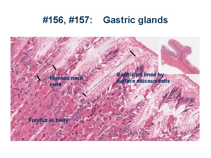 #156, #157: Mucous neck cells Fundus or body Gastric glands Gastric pit lined by