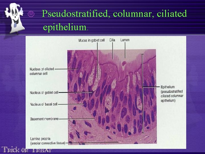 K Pseudostratified, columnar, ciliated epithelium. 