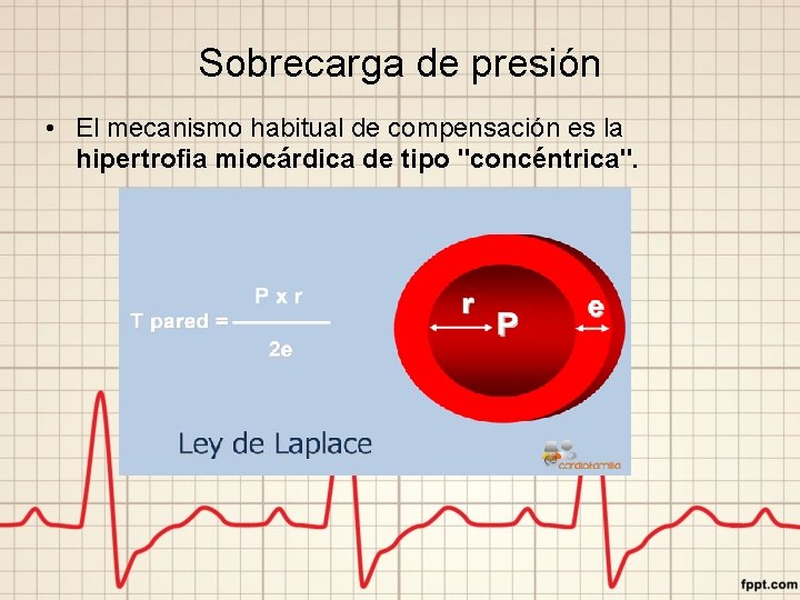 Sobrecarga de presión • El mecanismo habitual de compensación es la hipertrofia miocárdica de