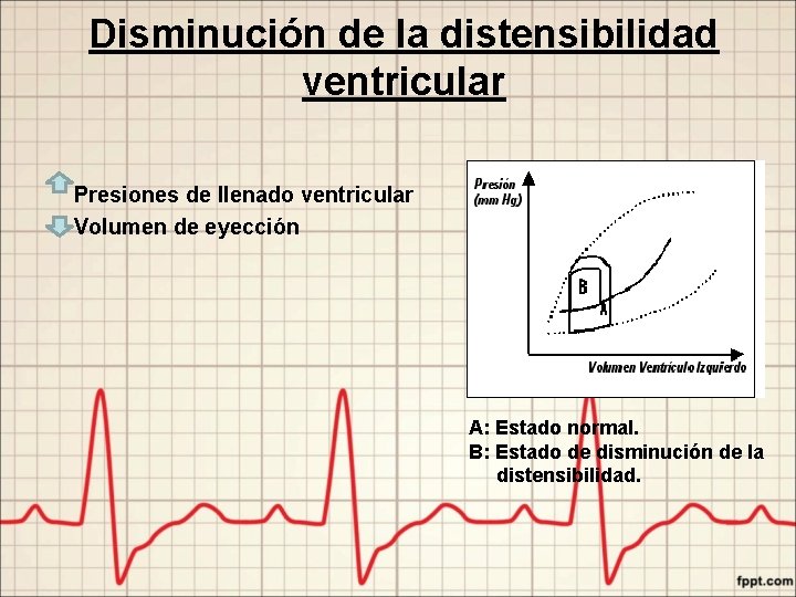 Disminución de la distensibilidad ventricular Presiones de llenado ventricular Volumen de eyección A: Estado