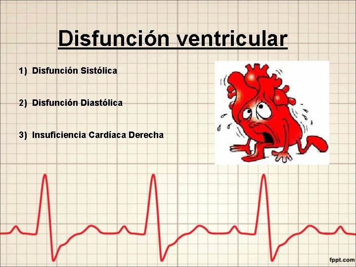 Disfunción ventricular 1) Disfunción Sistólica 2) Disfunción Diastólica 3) Insuficiencia Cardíaca Derecha 