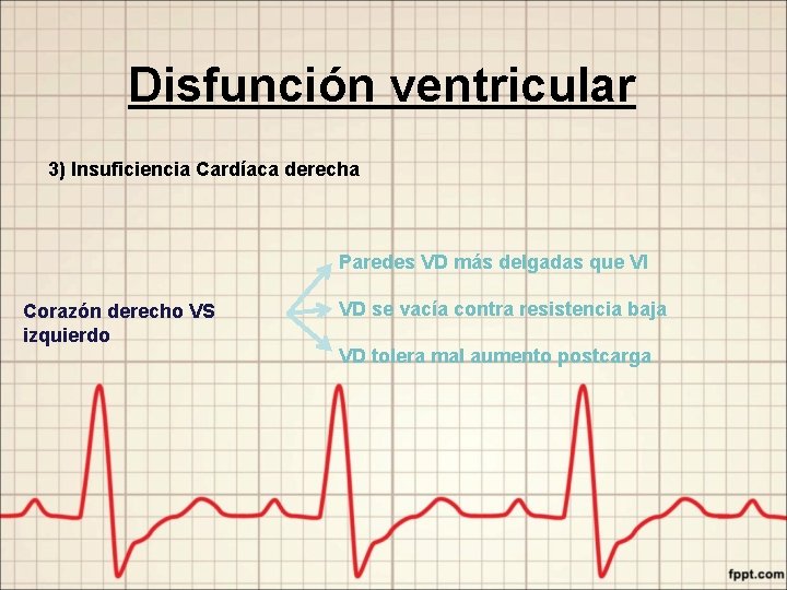 Disfunción ventricular 3) Insuficiencia Cardíaca derecha Paredes VD más delgadas que VI Corazón derecho