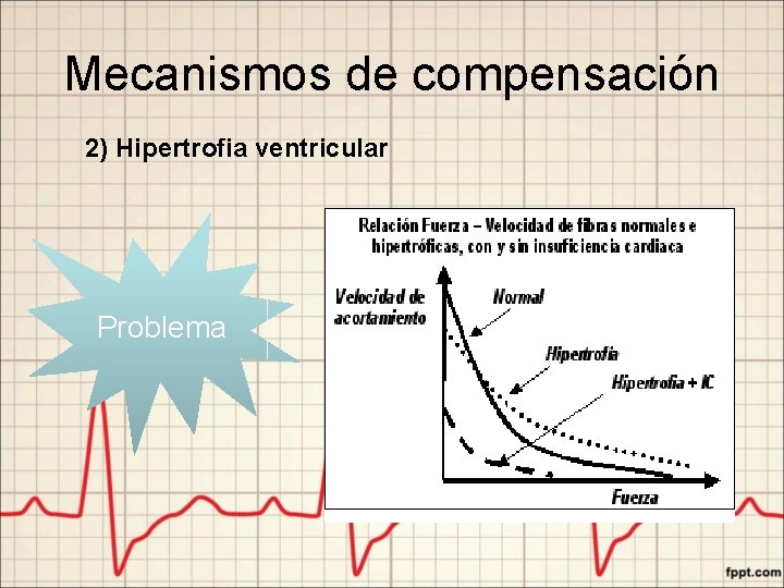 Mecanismos de compensación 2) Hipertrofia ventricular Problema 