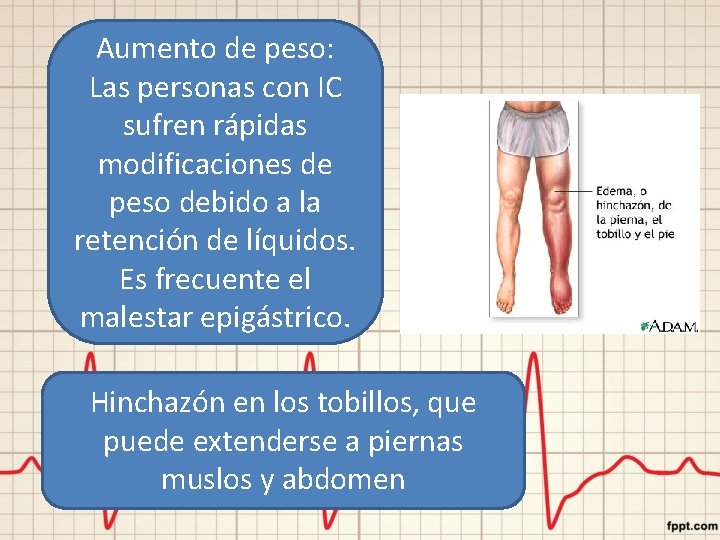 Aumento de peso: Las personas con IC sufren rápidas modificaciones de peso debido a