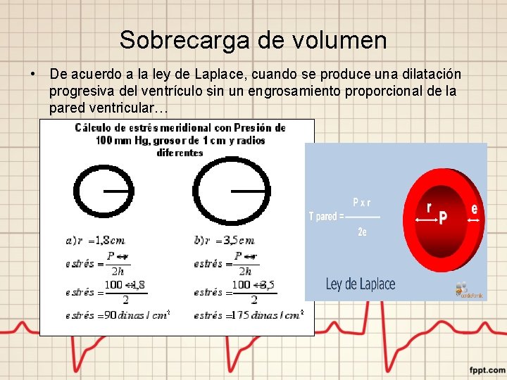 Sobrecarga de volumen • De acuerdo a la ley de Laplace, cuando se produce