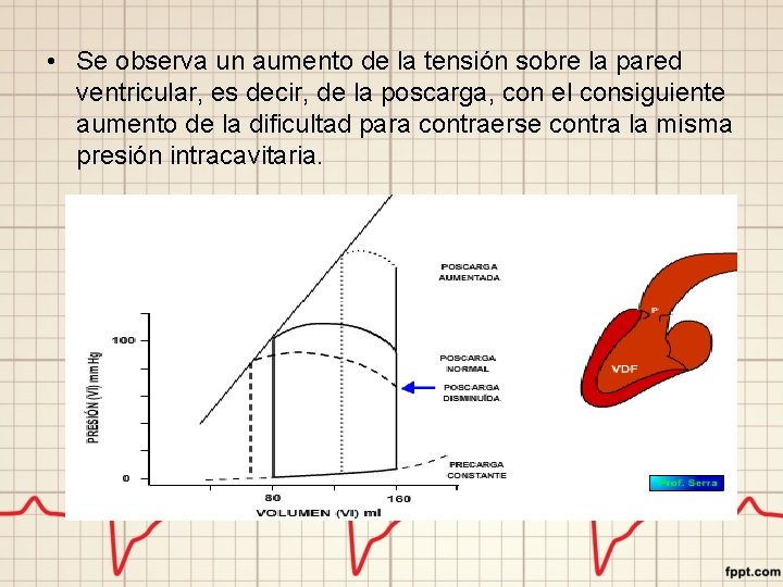  • Se observa un aumento de la tensión sobre la pared ventricular, es