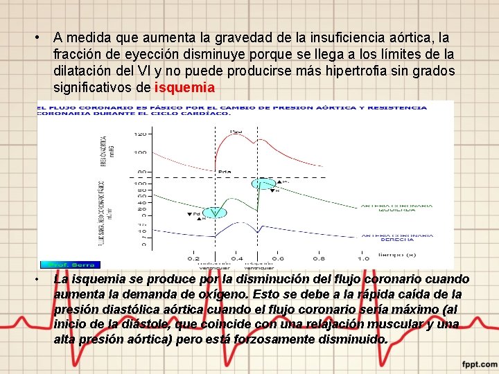  • A medida que aumenta la gravedad de la insuficiencia aórtica, la fracción