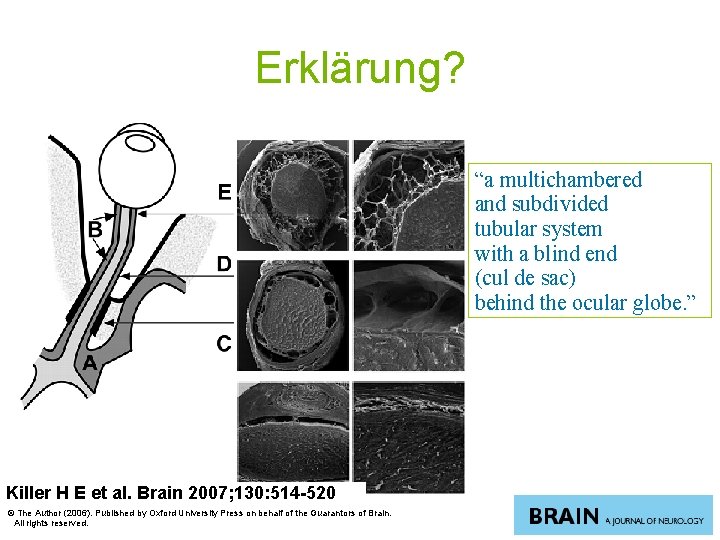 Erklärung? “a multichambered and subdivided tubular system with a blind end (cul de sac)