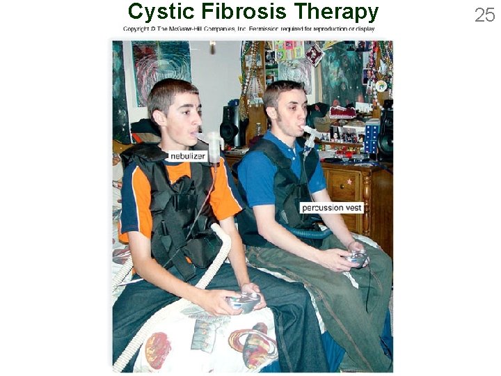 Cystic Fibrosis Therapy 25 