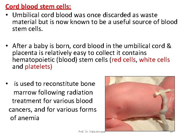 Cord blood stem cells: • Umbilical cord blood was once discarded as waste material