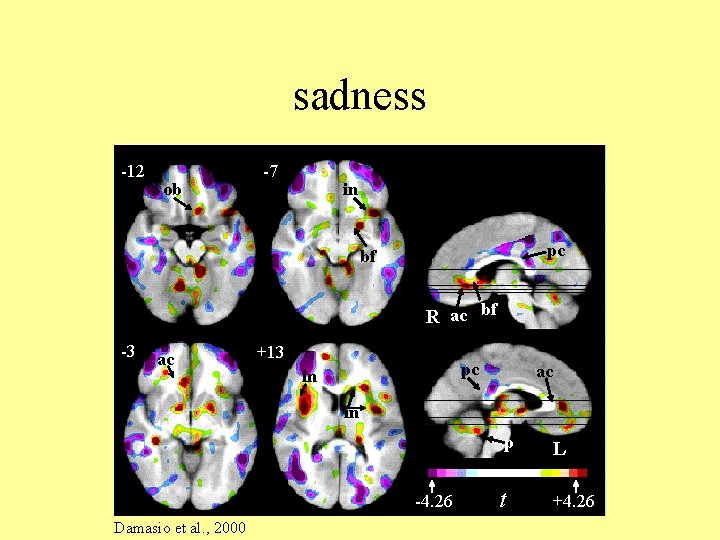 sadness -12 ob -7 in pc bf R ac bf -3 ac +13 pc