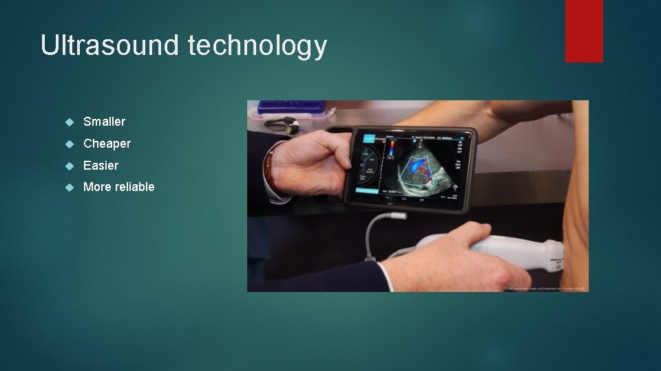 Ultrasound technology Smaller Cheaper Easier More reliable 