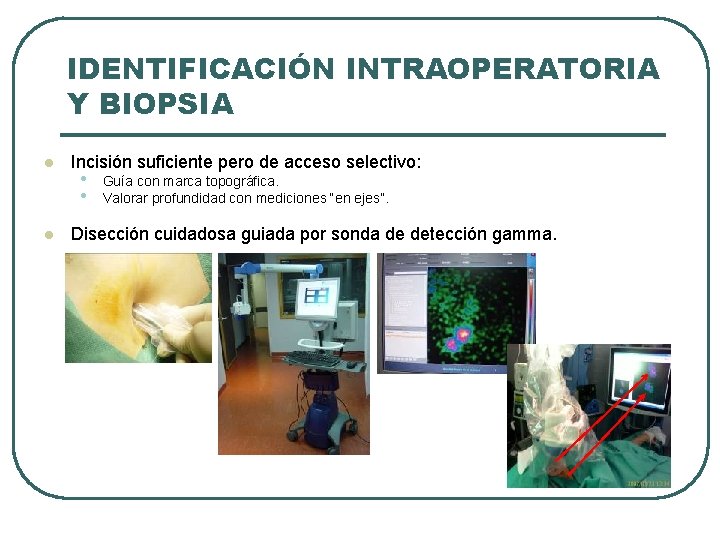 IDENTIFICACIÓN INTRAOPERATORIA Y BIOPSIA l l Incisión suficiente pero de acceso selectivo: • •