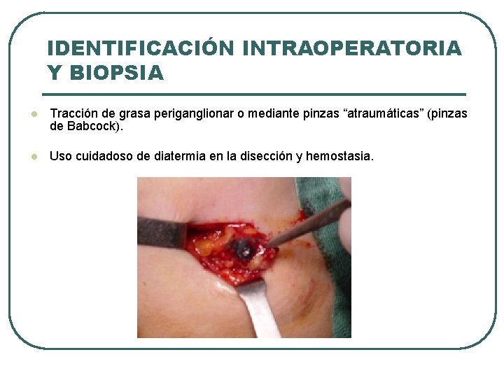 IDENTIFICACIÓN INTRAOPERATORIA Y BIOPSIA l Tracción de grasa periganglionar o mediante pinzas “atraumáticas” (pinzas