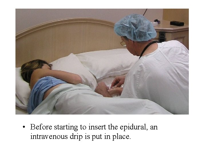  • Before starting to insert the epidural, an intravenous drip is put in
