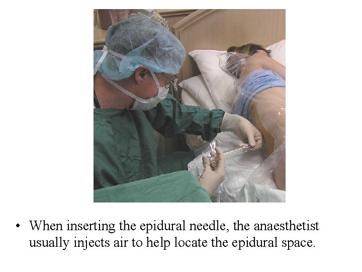  • When inserting the epidural needle, the anaesthetist usually injects air to help