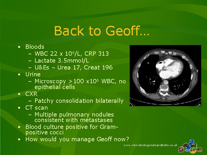 Back to Geoff… • Bloods – WBC 22 x 109/L, CRP 313 – Lactate