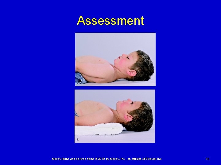 Assessment Mosby items and derived items © 2010 by Mosby, Inc. , an affiliate