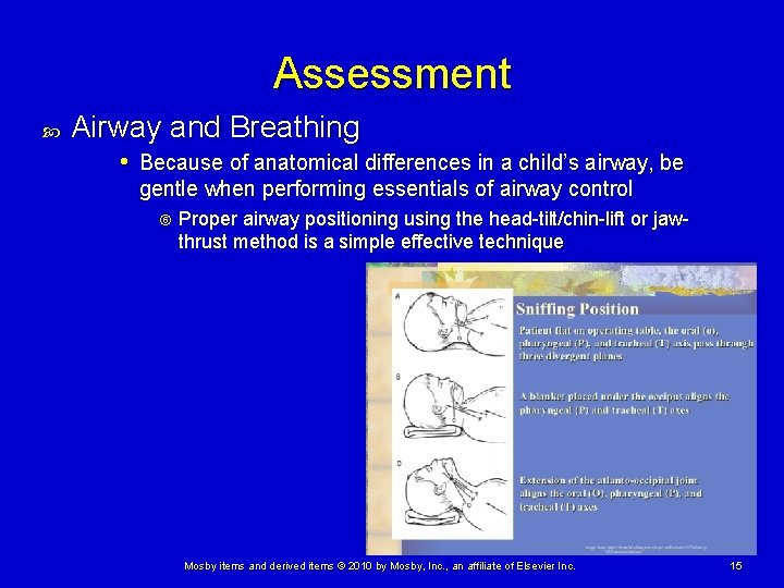 Assessment Airway and Breathing • Because of anatomical differences in a child’s airway, be