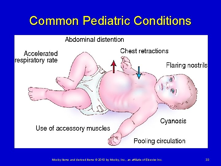 Common Pediatric Conditions Mosby items and derived items © 2010 by Mosby, Inc. ,