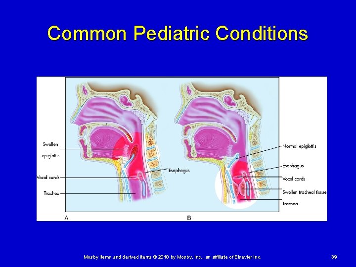 Common Pediatric Conditions Mosby items and derived items © 2010 by Mosby, Inc. ,