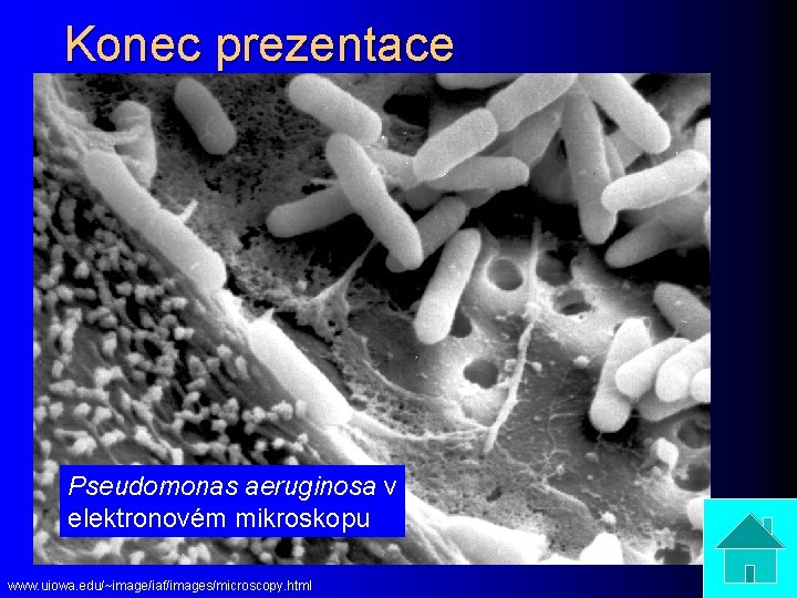 Konec prezentace Pseudomonas aeruginosa v elektronovém mikroskopu www. uiowa. edu/~image/iaf/images/microscopy. html 