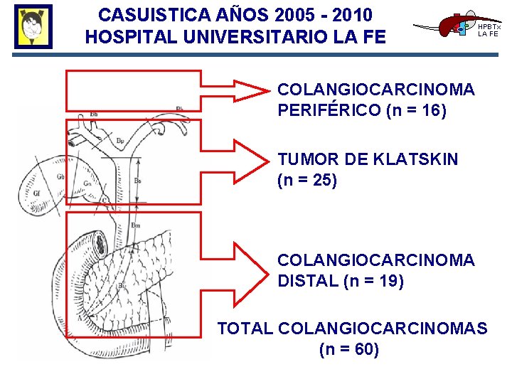 CASUISTICA AÑOS 2005 - 2010 HOSPITAL UNIVERSITARIO LA FE HPBTx LA FE COLANGIOCARCINOMA PERIFÉRICO