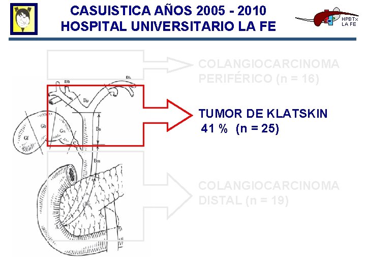 CASUISTICA AÑOS 2005 - 2010 HOSPITAL UNIVERSITARIO LA FE COLANGIOCARCINOMA PERIFÉRICO (n = 16)