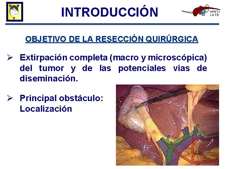 INTRODUCCIÓN OBJETIVO DE LA RESECCIÓN QUIRÚRGICA Ø Extirpación completa (macro y microscópica) del tumor