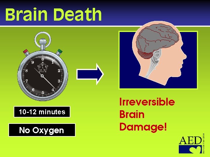 Brain Death 10 -12 minutes No Oxygen Irreversible Brain Damage! 