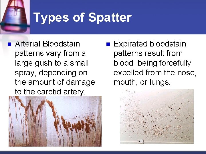 Types of Spatter n Arterial Bloodstain patterns vary from a large gush to a