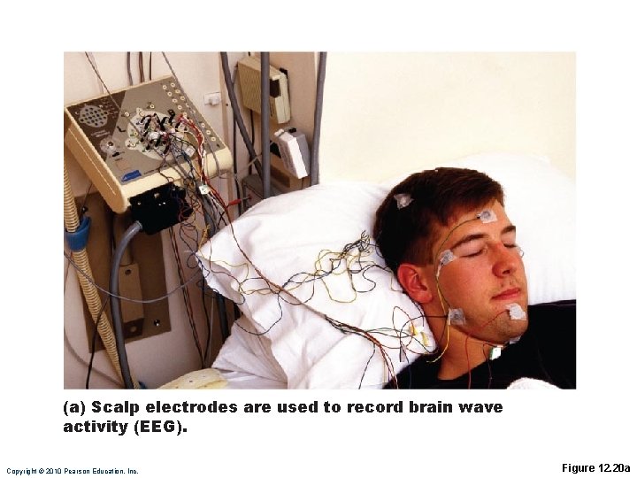 (a) Scalp electrodes are used to record brain wave activity (EEG). Copyright © 2010