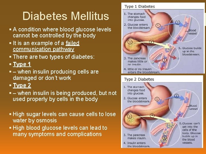 Diabetes Mellitus § A condition where blood glucose levels cannot be controlled by the