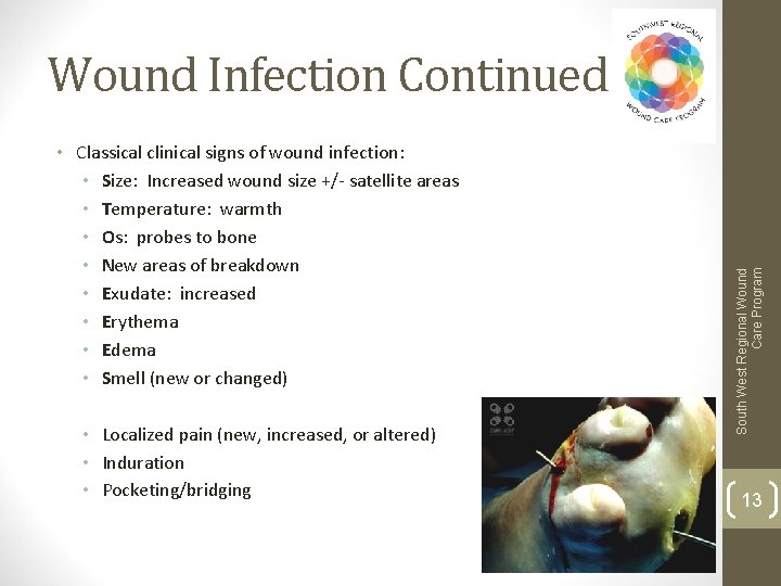  • Classical clinical signs of wound infection: • Size: Increased wound size +/-