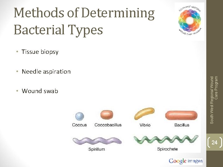 Methods of Determining Bacterial Types • Tissue biopsy • Wound swab South West Regional